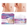 Scar Crema Vogsig Cicatrices Quirúrgicas Acné Quemaduras