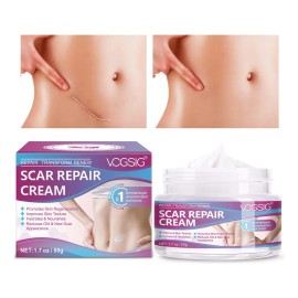 Scar Crema Vogsig Cicatrices Quirúrgicas Acné Quemaduras