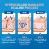Arme Hydrocolloid Gel Bandages for Fast Healing - 100 Pieces