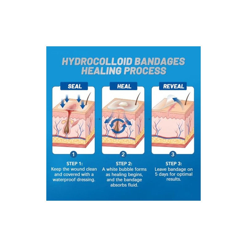 Arme Hydrocolloid Gel Bandages for Fast Healing - 100 Pieces