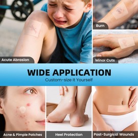 KISSYEE Hydrocolloid Roll for Wound Care, 2in x 16ft Large Medical Grade Hydrocolloid Bandages Patch with Self-Adhesive, Cut-to-Size, Ultra Absorbent, Flexible & Waterproof for Acne, Burn, Blister