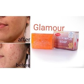 Renew X 3 soap New improved Renew anti pimples face soap 💯 satisfaction