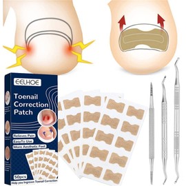 Health - Parche corrector de uñas de los pies, 50/100/150 unidades/juego de parches universales para uñas de los pies, ultrafinos y fuertes, cinta correctora de presión, calcomanías encarnadas de recuperación (150 unidades)