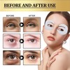 DEGHOUY E Shape Korean Eye Patches, 5 Pairs Deep Collagen