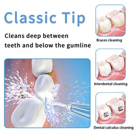 Replacement Heads for Waterpik Water Flosser,Replacement Tips for Waterpik(2 Classic Jet Tips)