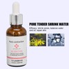 Small Bubble Blackhead Cleaner Kit Toner Blackhead Export Liquid Pore