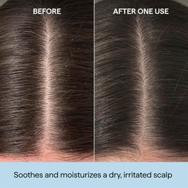 Scalp Revival Rosemary Pre-Wash Oil by Briogeo for Unisex - 3.4 oz Oil