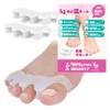 (Supervised by a The) Toe Separator, Toes Spread, Toes Spreading