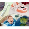 LED Dental Mirror with Light – Oral Inspection Tool for