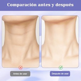 Crema Cuello Reafirmante Contiene Ácido Hialurónico Papada Adecuada Todo Tipo Piel Mejora Líneas Finas Esculpe Levanta Botellas