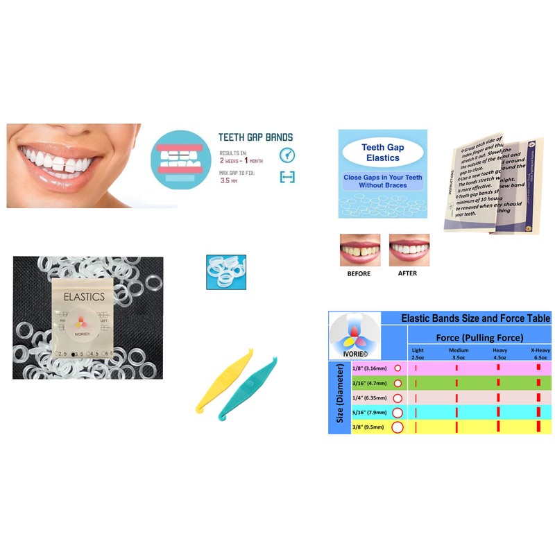 IVORIE Cosmetic Dental Elastic Rubber Bands Braces Teeth Gap Alignment