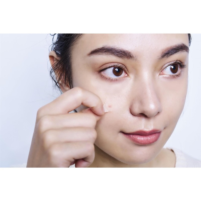 Cogit CICA method RECOVER PATCH