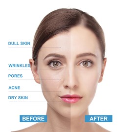 Exfoliating Facial Wash,Blueberry Facial Scrubs,Cleans Pores Gentle Exfoliation Moisturizer，Vitamin C Facial Scrub,Hydrating Face Scrub,Facial Exfoliating Facial Cleanser