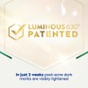 NIVEA Luminous 630 Post-Acne Dark Marks Serum (30ml), Facial Serum