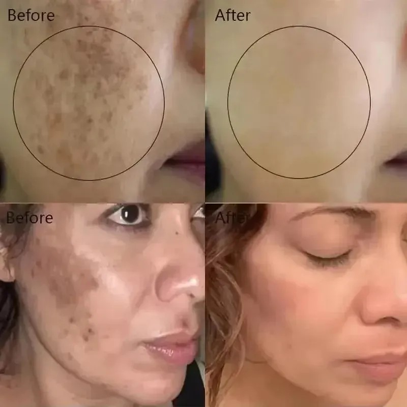 Sérum De Vitamina C, 3 Unidades, Iluminador Antiarrugas Ch