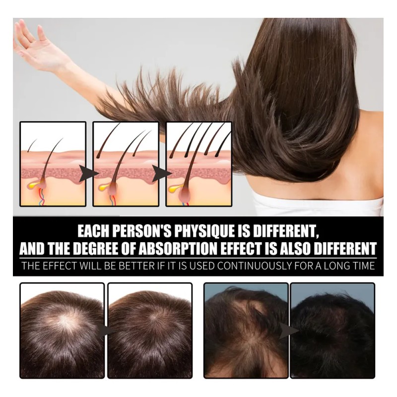 Aceite Para El Cuidado Del Cabello Con Colágeno Y Vitamina