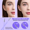 Teenitor Pimple Extractor Acne Treatment Tool Blackhead Comedone Removal 2-in-1