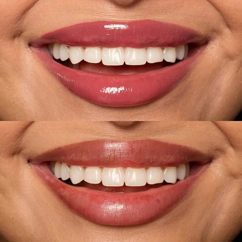 NYX PMU Lip IV, Gloss Serum Hidratante efecto tinta 5