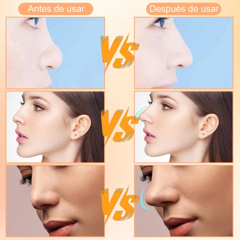 Respingador Nasal Corrector De Nariz 9 Pares 3 Ch, 3