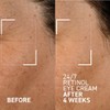 24-7 Retinol Eye Cream by Dr. Brandt for Women -