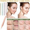 Aruicheng Blackhead Remover Tool Pimple Popping Kit Stainless Steel Comedone