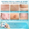 Silicone Scar Sheets, Silicone Scar Tape(1.8”x 157” Roll-4M), Silicone Scar