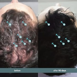 Ds Laboratories | Spectral® F7 Tratamiento Capilar con Ingredientes que Adaptan al Cabello Contra Agresiones Ambientales., Loción, Sin esencia, Mujere