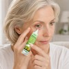 Vitamin E Milia Cream - Milia Daily Eye Care for