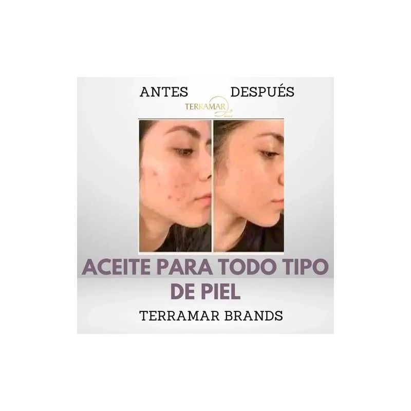 Aceite Óleo Facial Reparador Terramar De 30ml
