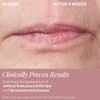 StriVectin, Double Fix™ for Lips Plumping & Vertical Line Treatment