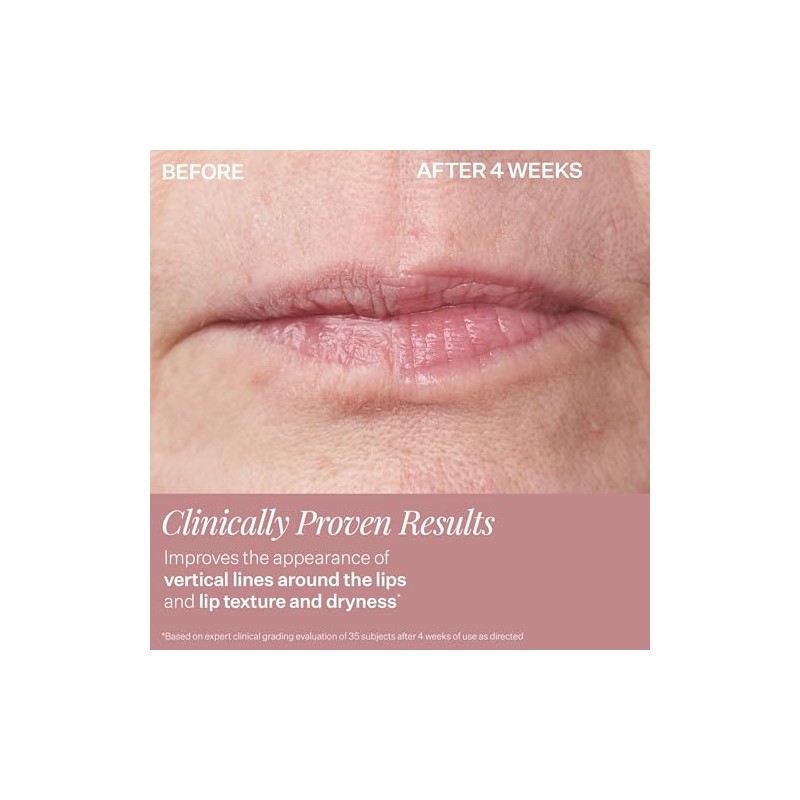 StriVectin, Double Fix™ for Lips Plumping & Vertical Line Treatment