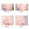 Ultrasonic Skin Scrubber Blackhead Removal Exfoliating Face Massage Pore Cleaner