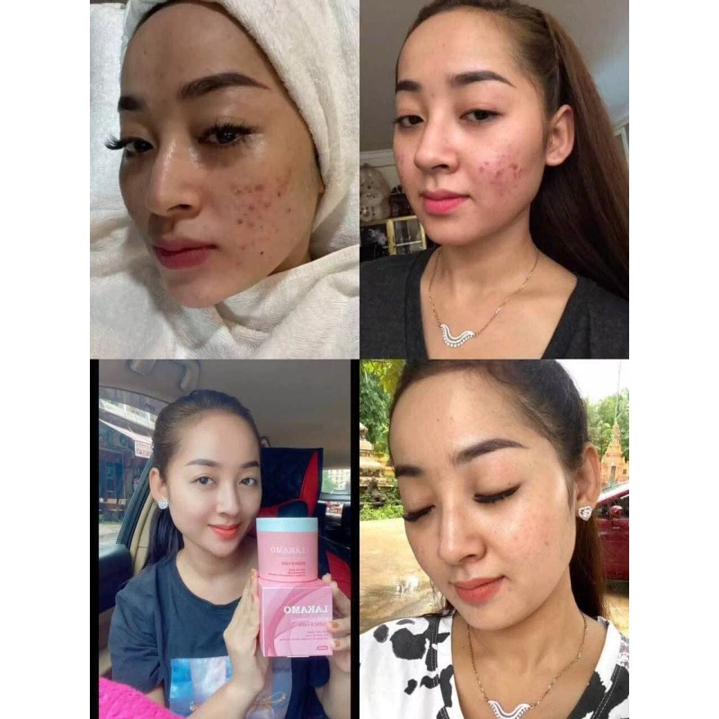 LAKAMO Pore Tightening Essence Pads សំឡីជូតមុខកូរ៉