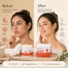 Herbal Face Cream for Blemish-Prone Skin – Oil-Control Moisturizer for