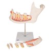 3B Scientific D25 6 Part Half Lower Jaw Model, 3