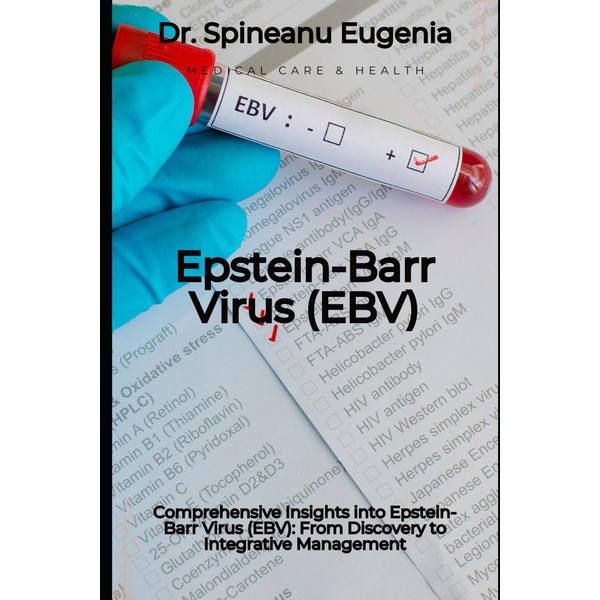 Comprehensive Insights into Epstein-Barr Virus (EBV): From Discovery to Integrative