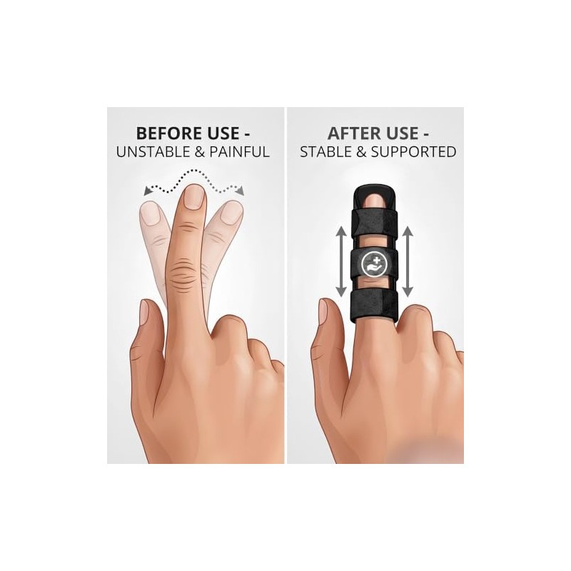 Finger Splint 3 Pack, Aluminium Finger Straightener & Immobiliser, Adjustable