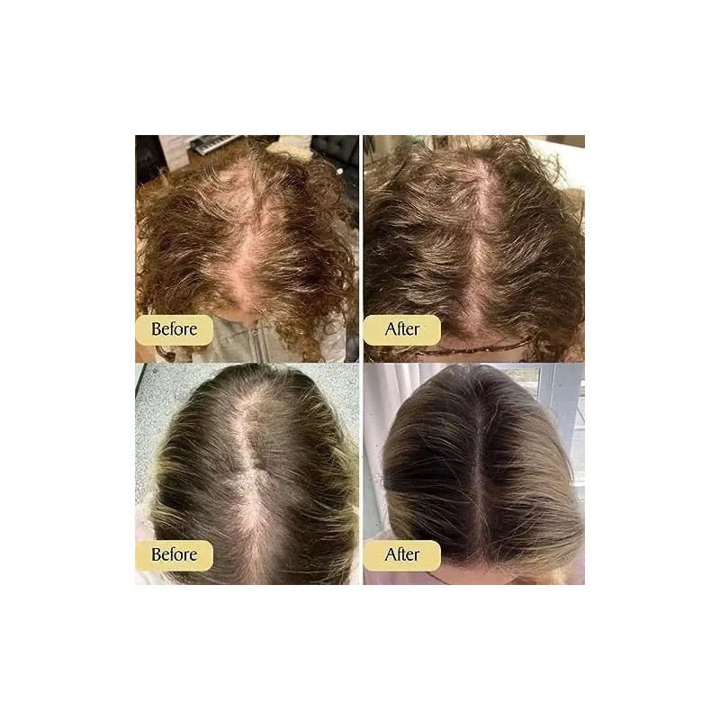 Aceite Vegano Natural Para El Crecimiento Del Cabello