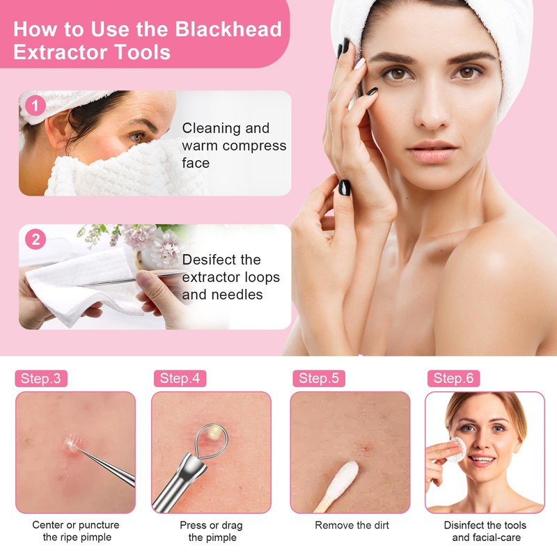 Fangze Blackhead Remover Tool Kit - 6pcs Pimple Popper Tool