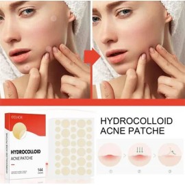 Parches Hidrocoloide Antiacné 144pzs Dia Y Noche 2 Medidas