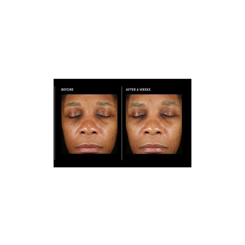 PCA Skin Hyaluronic Acid Overnight Mask 51g