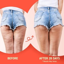 Enaskin Naturals Crema reafirmante corporal anticelulítica: Loción de glúteos para apretar y levantar con tecnología térmica 3D para muslos, vientre, 
