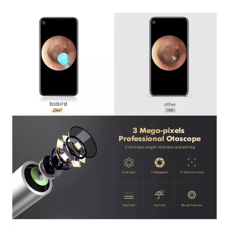 Bird BEBIRD X17 Pro Ear Wax Removal Camera Endoscope