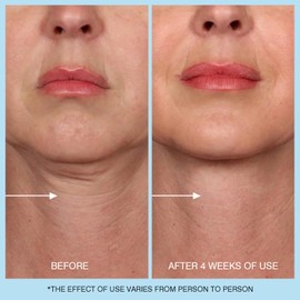 UJhay Retinol Neck Cream, Hyaluronic Acid and Caffeine Enriched Neck Firming Cream to Minimize Fine Lines & Dullness - 3-in-1 Moisturizing Cream for Neck, Chest and Face (50 ml/1.7 oz)