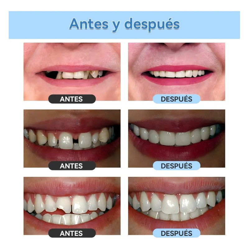 2pz Perlas Reparación Dientes Postizos Gránulos 30ml