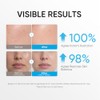 Skintific Crema Hidratante Facial con Ceramidas 5X, 100 G
