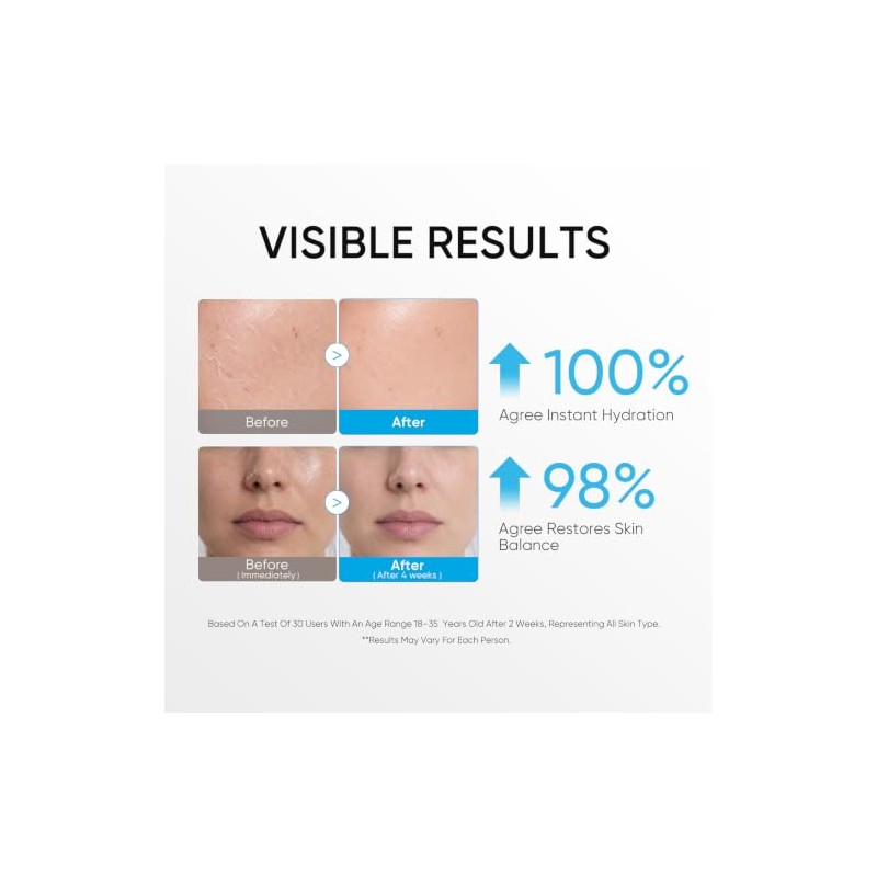 Skintific Crema Hidratante Facial con Ceramidas 5X, 100 G