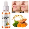 Turmeric Serum for Dark Spots, Reduces Hyperpigmentation, Age Spots, Sun