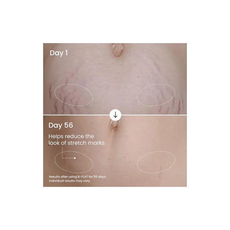 Crema Reafirmante Abdominal Maëlys B-flat Para Mujeres: Trat