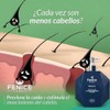 FENICE Shampoo Anticaida, Ayuda a Reducir la Caída del Cabello